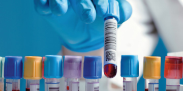 South African HIV Vaccine Trial Makes Global History